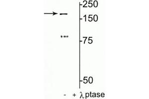 Western blot of rat hippocampal lysate showing specific immunolabeling of the ~180 kDa NR2B subunit of the NMDAR phosphorylated at Tyr1472 in the first lane (-). (GRIN2B antibody  (pTyr1472))