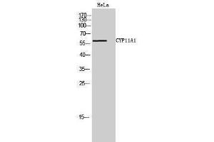 Western Blotting (WB) image for anti-Cytochrome P450, Family 11, Subfamily A, Polypeptide 1 (CYP11A1) (C-Term) antibody (ABIN3174630) (CYP11A1 antibody  (C-Term))