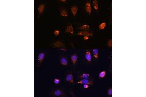 Immunofluorescence analysis of U-2 OS cells using RPL34 antibody (ABIN7270003) at dilution of 1:100. (RPL34 antibody  (AA 1-117))