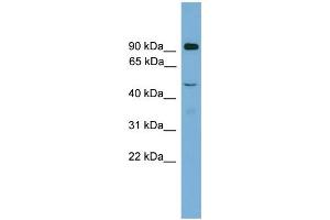 WB Suggested Anti-Zfy2 Antibody Titration: 0.