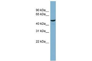 WB Suggested Anti-C22orf28 Antibody Titration: 0. (C22orf28 antibody  (Middle Region))