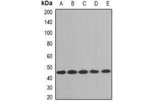 Western blot analysis of Aminoacylase 1 expression in A431 (A), Jurdat (B), mouse brain (C), mouse liver (D), rat kidney (E) whole cell lysates. (Aminoacylase 1 antibody)