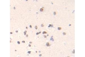 Figure. (SPIN3 antibody  (AA 1-77))