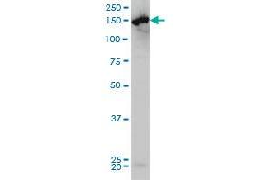 CPS1 monoclonal antibody (M01), clone 8H8 Western Blot analysis of CPS1 expression in HeLa . (CPS1 antibody  (AA 1400-1500))