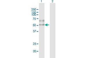 Western Blot analysis of ENTPD1 expression in transfected 293T cell line by ENTPD1 MaxPab polyclonal antibody. (CD39 antibody  (AA 1-510))