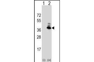 Western Blotting (WB) image for anti-Aspartoacylase (ASPA) (AA 82-110), (N-Term) antibody (ABIN390843)