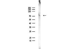 Western blot analysis of lysates from Mouse spleen, using SCL Antibody at 1/1000 dilution.