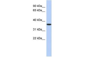 WB Suggested Anti-MVK Antibody Titration: 0. (MVK antibody  (N-Term))