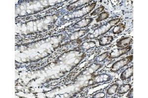 IHC analysis of PRDM5 using anti-PRDM5 antibody (ABIN7600853).