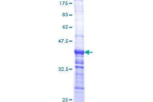 Image no. 1 for Laminin, alpha 2 (LAMA2) (AA 3013-3122) protein (GST tag) (ABIN1309119) (Laminin Protein (AA 3013-3122) (GST tag))