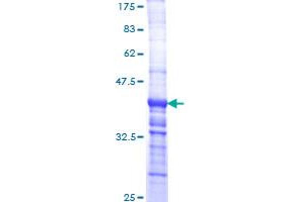Laminin Protein (AA 3013-3122) (GST tag)