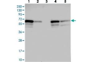 Western blot analysis of Lane 1: RT-4, Lane 2: U-251 MG, Lane 3: Human Plasma, Lane 4: Liver, Lane 5: Tonsil with C14orf159 polyclonal antibody  at 1:250-1:500 dilution. (C14ORF159 antibody)