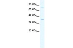 Western Blotting (WB) image for anti-Minichromosome Maintenance Deficient 4 (MCM4) antibody (ABIN2461392) (MCM4 antibody)