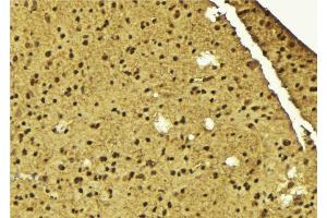 ABIN6275604 at 1/100 staining Mouse brain tissue by IHC-P. (SF3B4 antibody  (N-Term))