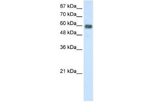 WB Suggested Anti-TROVE2 Antibody Titration:  2.