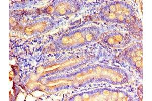 Immunohistochemistry of paraffin-embedded human small intestine tissue using ABIN7159734 at dilution of 1:100 (MTTP antibody  (AA 19-151))