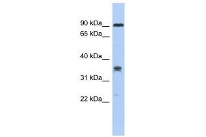 C6ORF154 antibody used at 1 ug/ml to detect target protein. (C6orf154 antibody  (Middle Region))