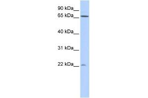WB Suggested Anti-DIRAS1 Antibody Titration: 0. (DIRAS1 antibody  (N-Term))