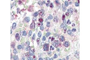 IHC analysis of FFPE human spleen tissue stained with anti-SNAIL antibody (SNAIL antibody  (AA 9-39))