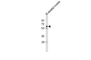 Anti-Smarcd3 Antibody (Center) at 1:4000 dilution + mouse skeletal muscle lysates Lysates/proteins at 20 μg per lane. (SMARCD3 antibody  (AA 158-193))