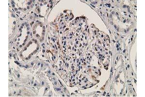Immunohistochemical staining of paraffin-embedded Human Kidney tissue using anti-OGFOD1 mouse monoclonal antibody. (OGFOD1 antibody)