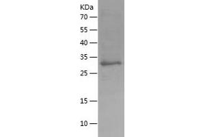 Western Blotting (WB) image for Hepcidin Antimicrobial Peptide (HAMP) (AA 23-83) protein (His-IF2DI Tag) (ABIN7283383) (Hepcidin Protein (AA 23-83) (His-IF2DI Tag))