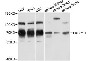 Western blot analysis of extracts of various cell lines, using FKBP10 antibody (ABIN6290381) at 1:3000 dilution. (FKBP10 antibody)