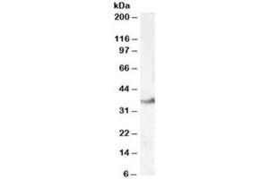 Western blot testing of human kidney lysate with LASP1 antibody at 0. (LASP1 antibody)