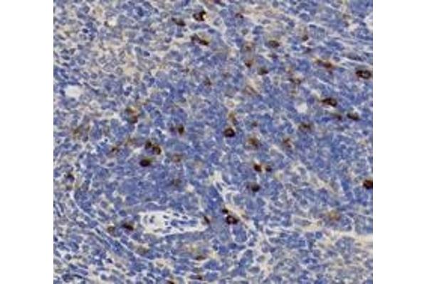 CHERP antibody