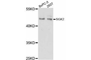 Western blot analysis of extracts of various cell lines, using SGK2 antibody (ABIN5998798) at 1/1000 dilution. (SGK2 antibody)