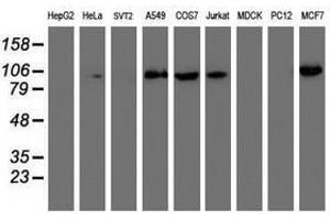Image no. 1 for anti-phosphofructokinase, Platelet (PFKP) antibody (ABIN1500165) (PFKP antibody)