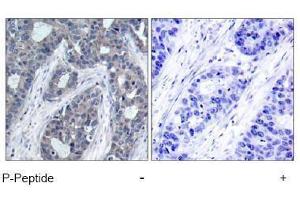 Image no. 1 for anti-Insulin Receptor Substrate 1 (IRS1) (pSer636) antibody (ABIN196978) (IRS1 antibody  (pSer636))
