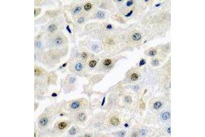 Immunohistochemical analysis of p54nrb staining in rat liver  formalin fixed paraffin embedded tissue section. (NONO antibody)