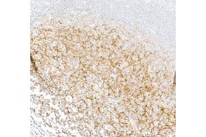Immunohistochemistry (IHC) image for anti-Complement Component (3d/Epstein Barr Virus) Receptor 2 (CR2) (C-Term) antibody (ABIN7795815) (Recombinant CD21 antibody  (C-Term))