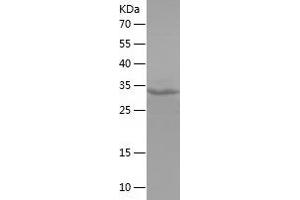 Western Blotting (WB) image for serine/threonine/tyrosine Kinase 1 (STYK1) (AA 53-176) protein (His-IF2DI Tag) (ABIN7125045)