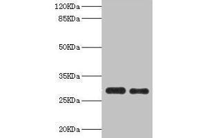 Western blot All lanes: PSME1 antibody at 0. (PSME1 antibody  (AA 1-249))