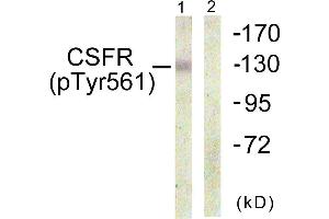 Immunohistochemistry analysis of paraffin-embedded human brain using CSFR (Phospho-Tyr561) antibody. (CSF1R antibody  (pTyr561))