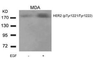 Image no. 2 for anti-Receptor tyrosine-protein kinase erbB-2 (ErbB2/Her2) (pTyr1221), (pTyr1222) antibody (ABIN196750) (ErbB2/Her2 antibody  (pTyr1221, pTyr1222))