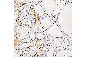 IHC analysis of SNRNP40 using anti-SNRNP40 antibody (ABIN7601719).