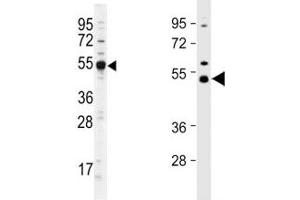 Western blot analysis of Dnmt2 antibody and different lots of mouse cerebellum lysate. (Dnmt2 antibody  (AA 346-375))