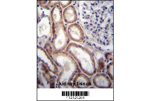 SLIT1 Antibody immunohistochemistry analysis in formalin fixed and paraffin embedded human kidney tissue followed by peroxidase conjugation of the secondary antibody and DAB staining. (SLIT1 antibody  (N-Term))