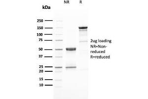 SDS-PAGE Analysis Purified HER-2 Mouse Monoclonal Antibody (ERBB2/3080). (ErbB2/Her2 antibody  (AA 311-462))