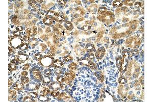 C3orf31 antibody was used for immunohistochemistry at a concentration of 4-8 ug/ml. (TAM41 antibody  (N-Term))