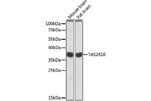Western blot analysis of extracts of various cell lines, using TAS2R10 antibody. (TAS2R10 antibody)