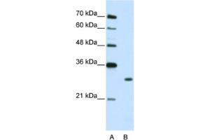 Western Blotting (WB) image for anti-Muscleblind-like Protein 1 (MBNL1) antibody (ABIN2462372) (MBNL1 antibody)