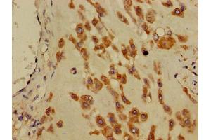 Immunohistochemistry of paraffin-embedded human placenta tissue using ABIN7150506 at dilution of 1:100 (DNAJB11 antibody  (AA 53-238))