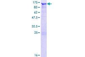 Angiomotin Protein (AMOT) (AA 1-675) (GST tag)