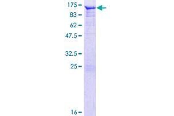 Angiomotin Protein (AMOT) (AA 1-675) (GST tag)