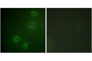 Immunofluorescence (IF) image for anti-Integrin beta 1 (ITGB1) (AA 749-798), (pThr789) antibody (ABIN1531326)