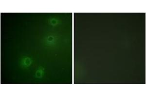 Immunofluorescence analysis of COS7 cells, using Integrin beta1 (Phospho-Thr789) Antibody. (ITGB1 antibody  (pThr789))